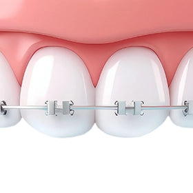 Brackets y soportes